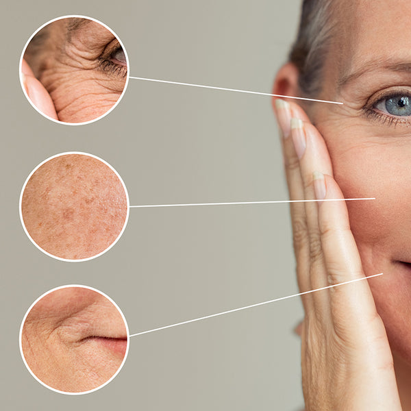 affects of aging and loss of collagen in skin