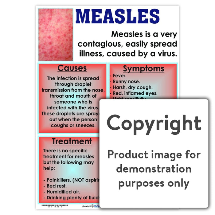 measles ppt presentation free download