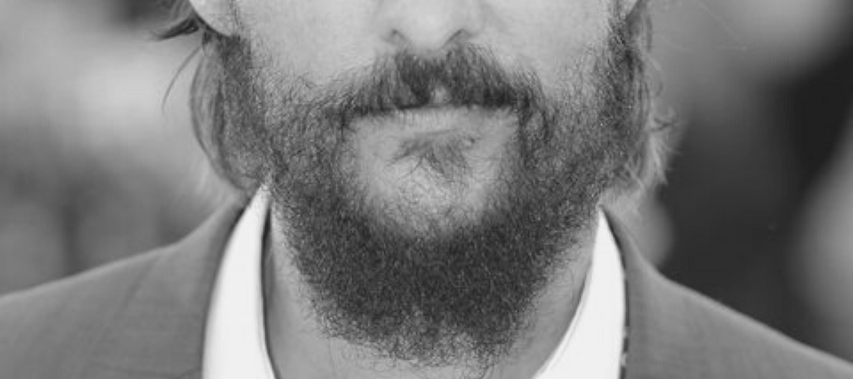 Featured image of post Rogaine For Beard Before And After It will also discuss how long it may take to see results and how you may be able to speed up the