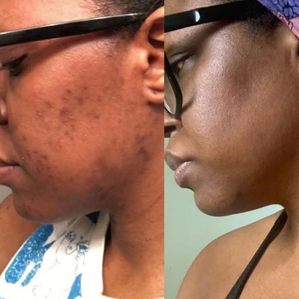 Face Forward Rejuvenating Facial Oil - Crambé Skincare