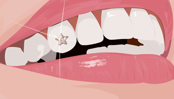 Twinkles tooth gem 1