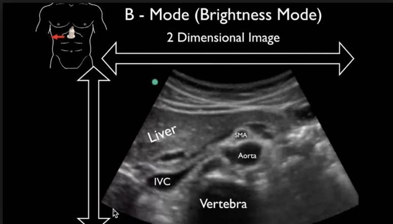 Medical illustration showing a hand holding an ultrasound machine