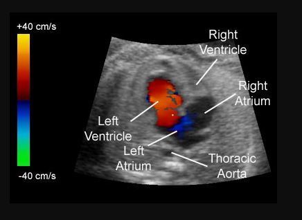 How It Works: Doppler Ultrasound Imaging