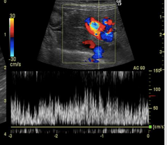 How It Works: Ultrasound Modes