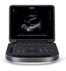 Sonosite Edge II portable ultrasound