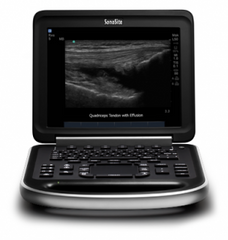 Sonosite Edge Portable Ultrasound