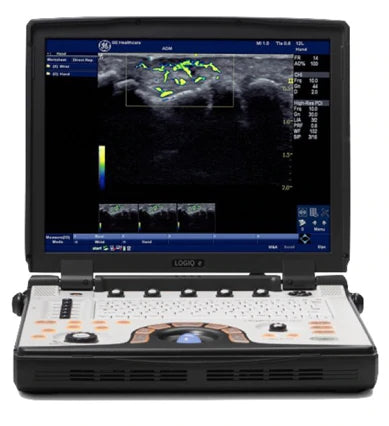 GE Logiq E NextGen Ultrasound