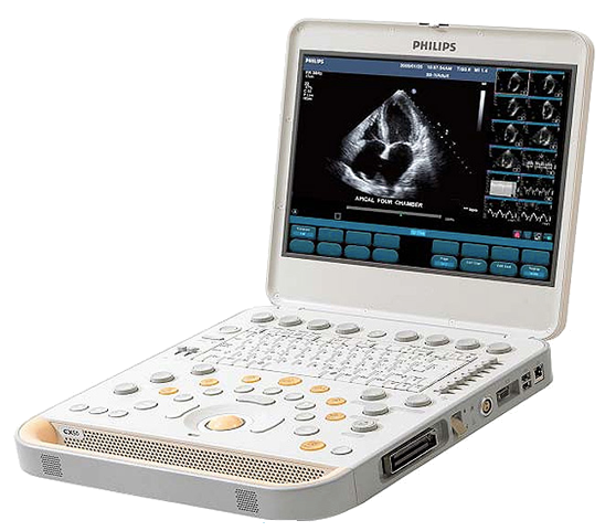 CX30 Mid Range Ultrasound System