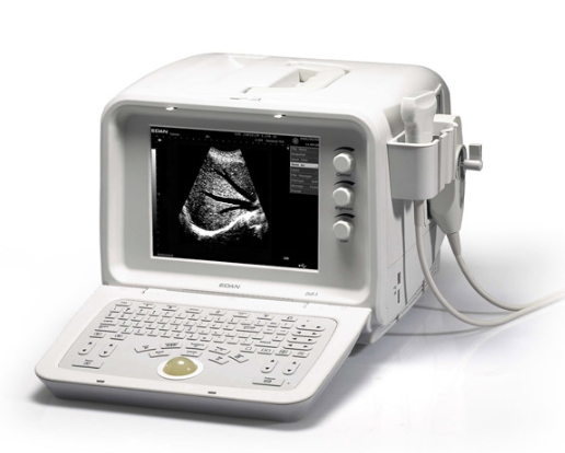 Edan DUS 6 Portable Ultrasound System