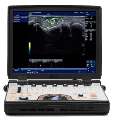 Image of GE Logiq E NextGen Portable Ultrasound Machine