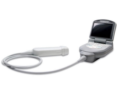 Siemens Acuson P10 portable ultrasound system