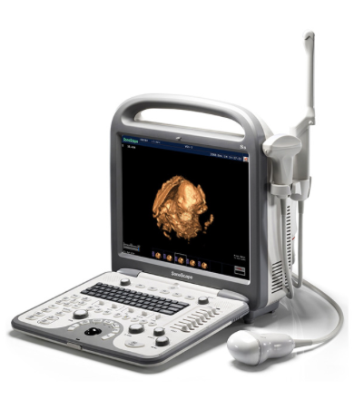 Sonoscape S8 Portable Ultrasound System
