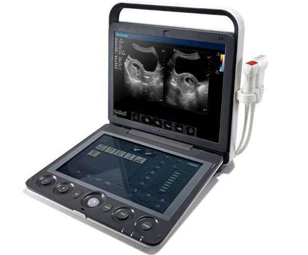 Sonoscape S9 Portable Ultrasound System