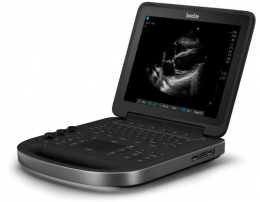 Edge II Vascular and General Imaging Ultrasound System