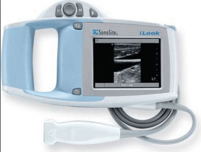 Sonosite iLook 25 portable ultrasound machine