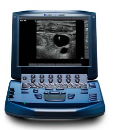 Sonosite Micromaxx Portable Ultrasound System