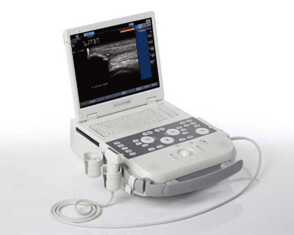 Siemens Acuson P300 shared service portable ultrasound machine