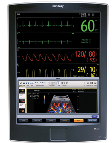 Patient Monitoring Systems : Patient Monitors by Mindray