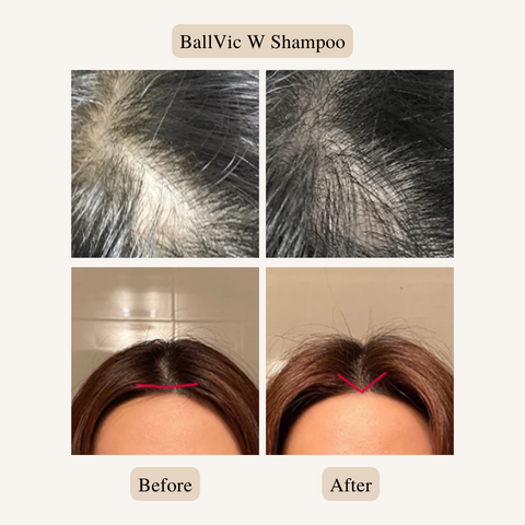 Say goodbye to hair loss with this powerful shampoo for women. Packed with natural ingredients like argan oil, saw palmetto, and caffeine, this shampoo revitalizes the scalp and promotes healthy hair growth. Its gentle formula is suitable for all hair types and is free of harsh chemicals that can damage your locks. #hairloss #thinninghair #hairgrowth