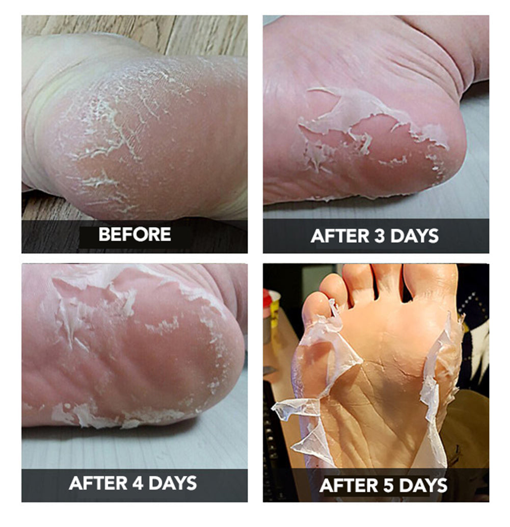 Sala&Su Foot Peeling Mask Product Description 2