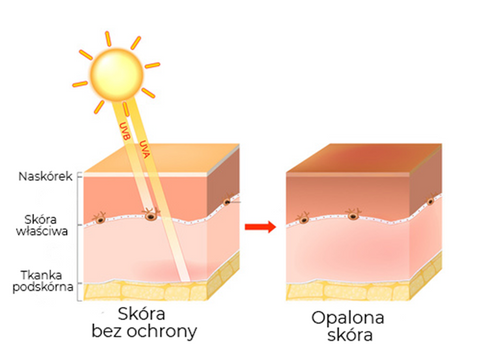 skóra-opalenizna