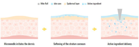 MICROLL ABSORPTION PROCESS