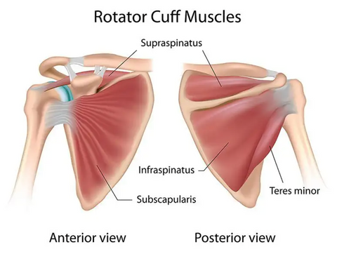 diagram drawing demonstrates how rotator cuff surgery is performed