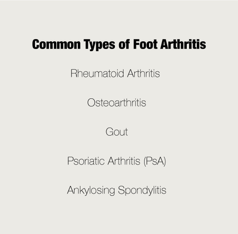 Common types of foot arthritis