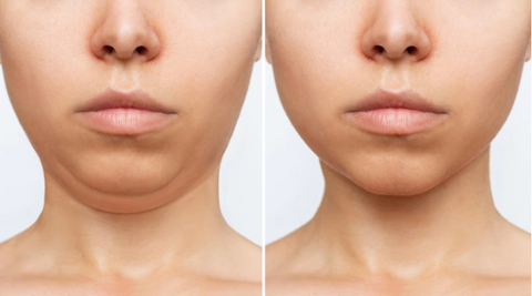 face yoga for double chin removal by vibhuti arora from house of beauty india