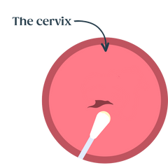 An illustration of the cervix