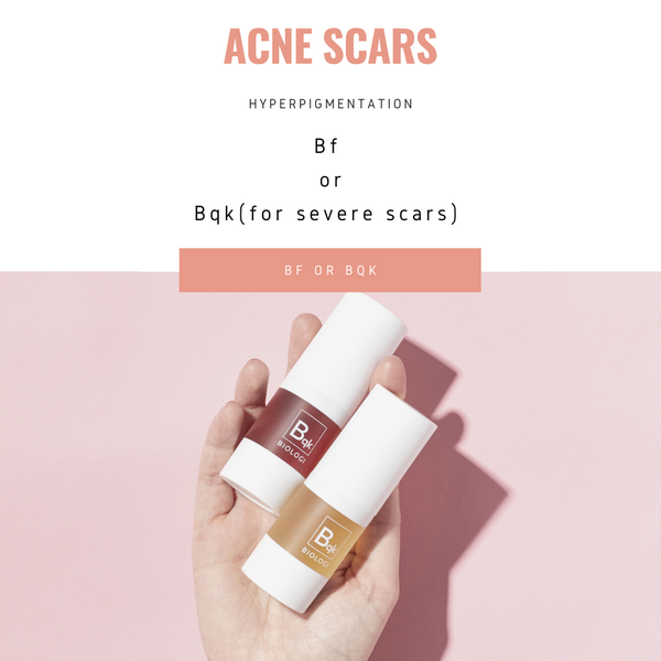 Biologi helps with Acne Scars