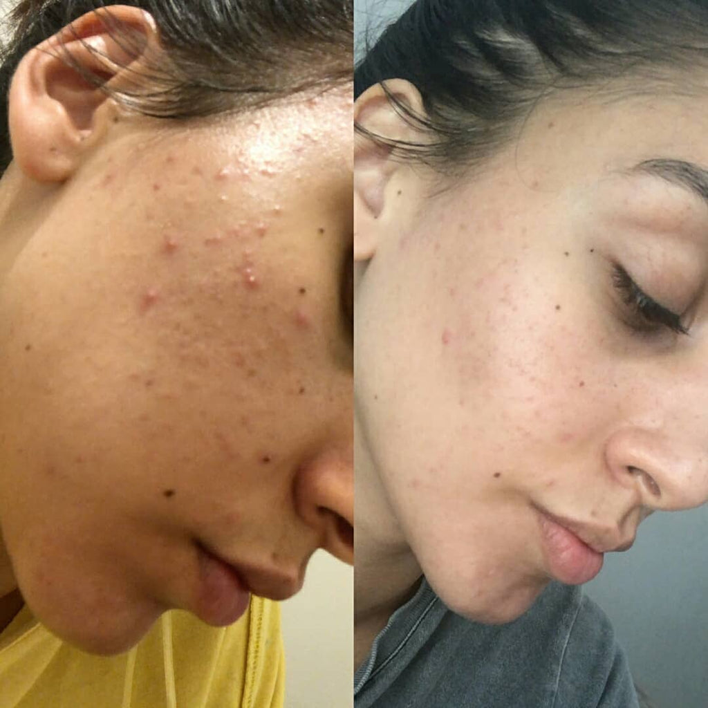 Biologi - Before and After serum use