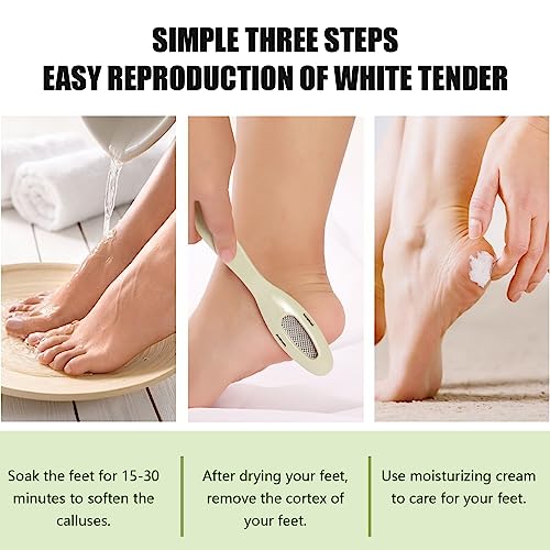 WLLHYF 4 Pieces Double Sided Pedicure Foot File Foot Scraper, Exfoliator  Remover Dead Skin Hard Skin