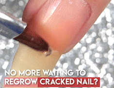 Cracked Nail Repair Gel 