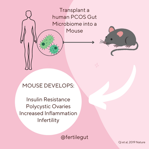 FMT PCOS GUt Microbiome