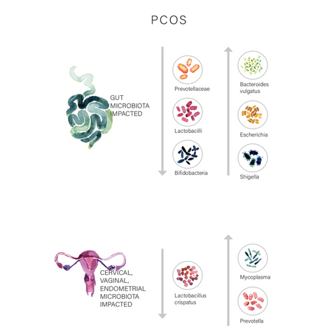PCOS Gut Microbiome