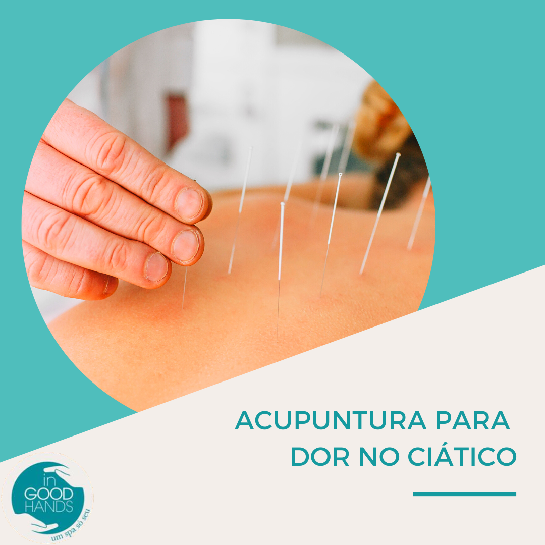 Acupuntura para dor no ciático