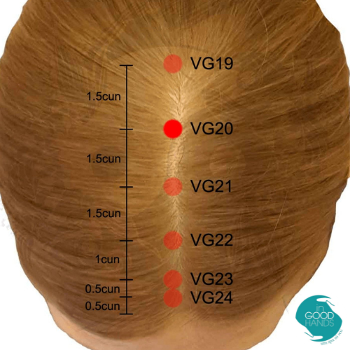 Pontos VB20 e VB21 para dor de cabeça e enxaqueca