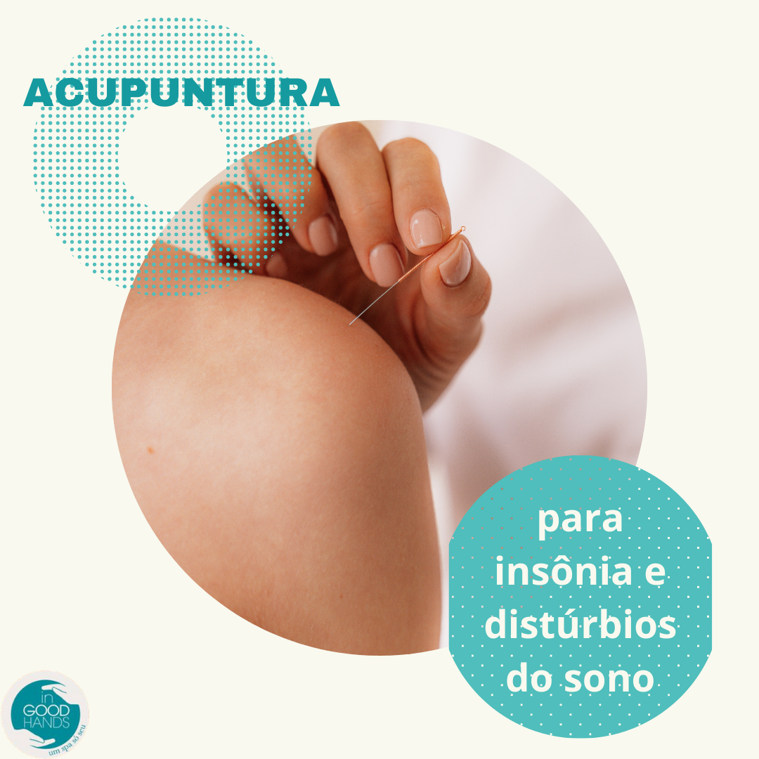 Acupuntura para insônia