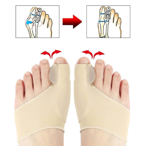 Correcteur Hallux Valgus, Orthese Orteil Separatateur