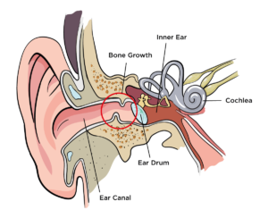 ear diagram