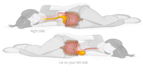 Left side sleeping for heartburn, home remedies for reflux during pregnancy