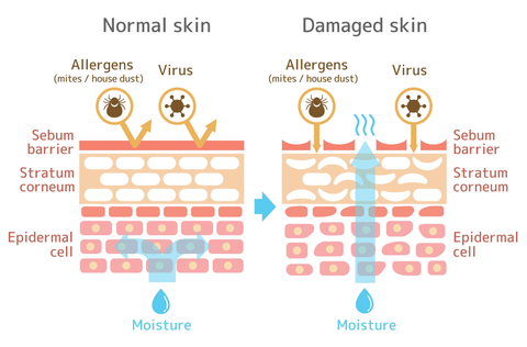 Normal Skin vs Damaged Skin Image Charts