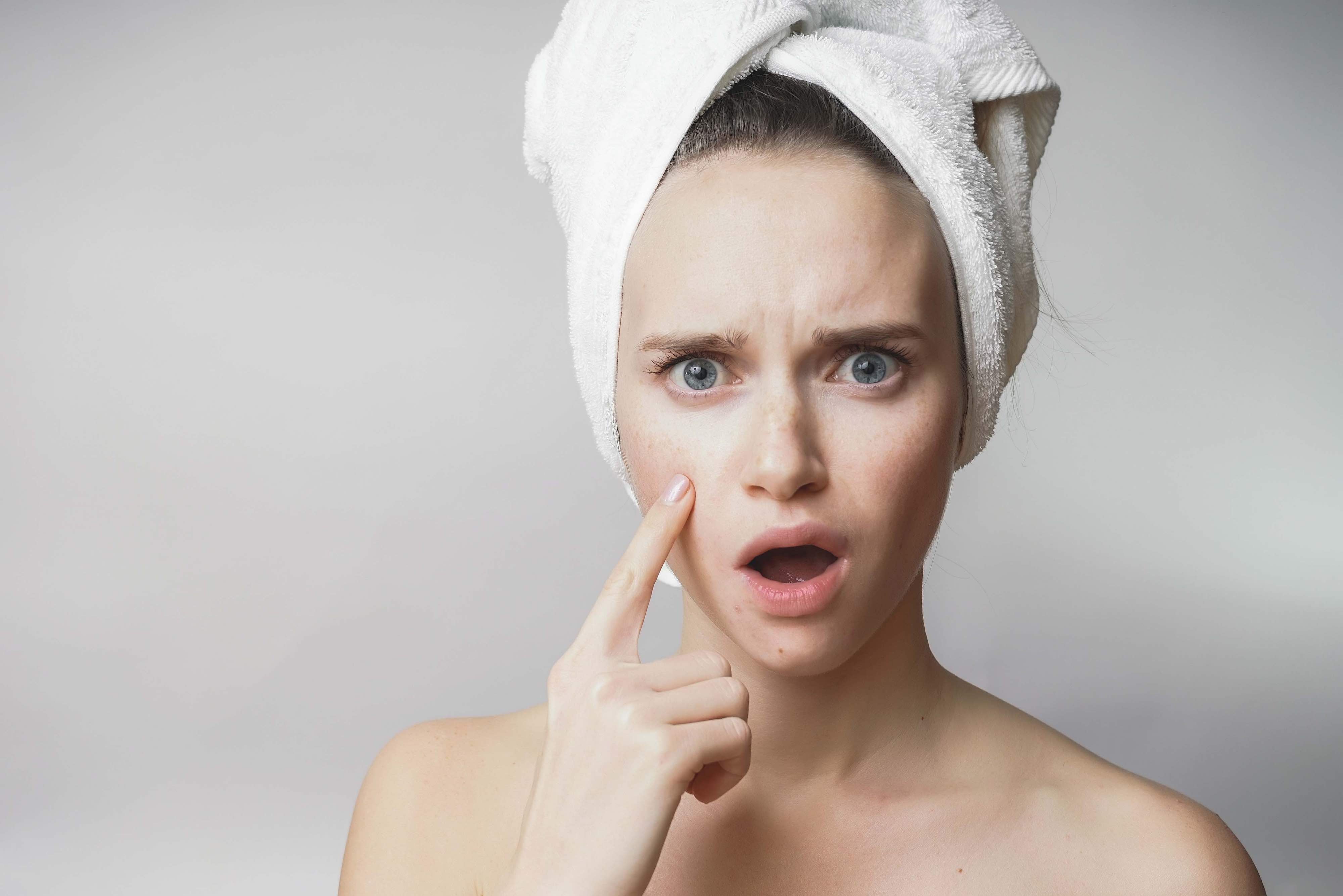 Image of Woman looking at her acne, and worrying about it.