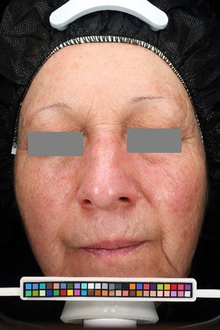 Woman with Roseca - before picture