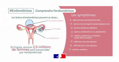 Symptom einer Endometriose sind Unterleibsschmerzen