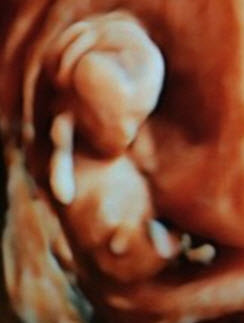 4D/5D Baby Ultrasound picture
