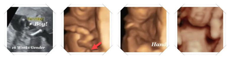 16 week ultrasound gender image scans