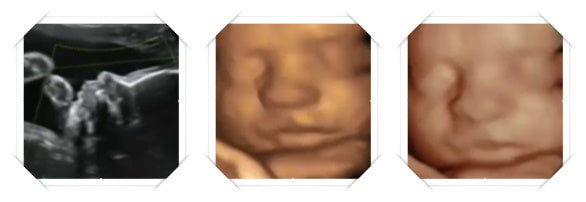 27 week ultrasound image scans