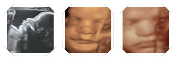 29 week ultrasound image scans